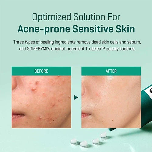 Some By Mi - AHA BHA PHA 14 Days Super Miracle Spot Kill Cream